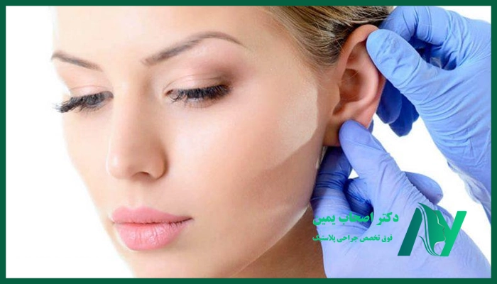 جراحی زیبایی گوش برای چه کسانی مناسب است؟