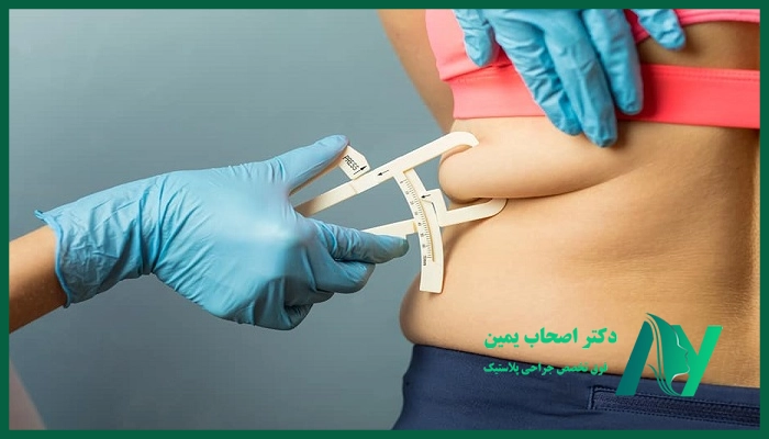 مزایای لاغری با لیپولیزر