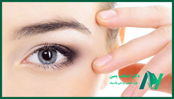 بهترین جراح لیفت ابرو در کرمان