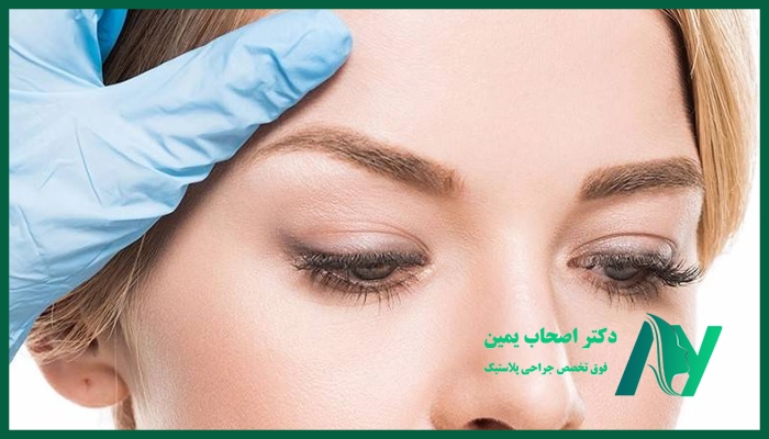 لیفت ابرو چیست؟