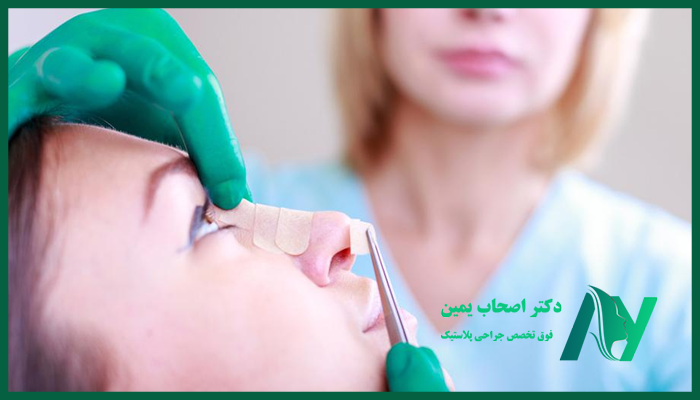 نحوه چسب زدن بینی بعد از عمل