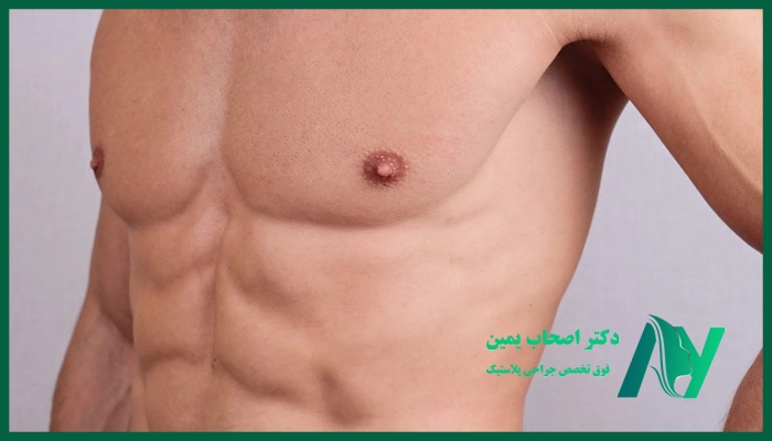 مراحل انجام جراحی ژنیکوماستی