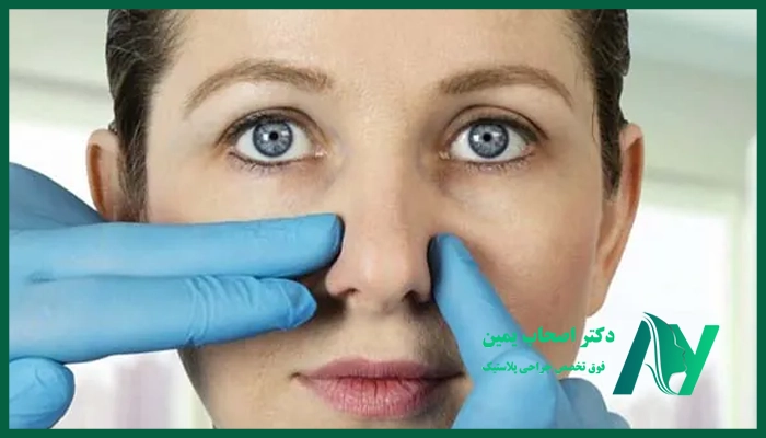 نکات مراقبتی بعد از عمل پولیپ بینی