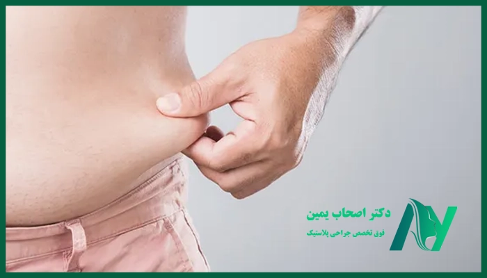 نکاتی که بعد ازلیپولیز باید رعایت کرد!