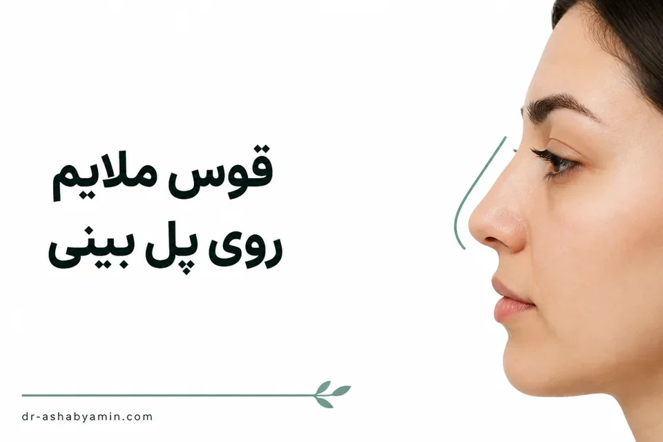 قوس ملایم و متناسب روی پل بینی
